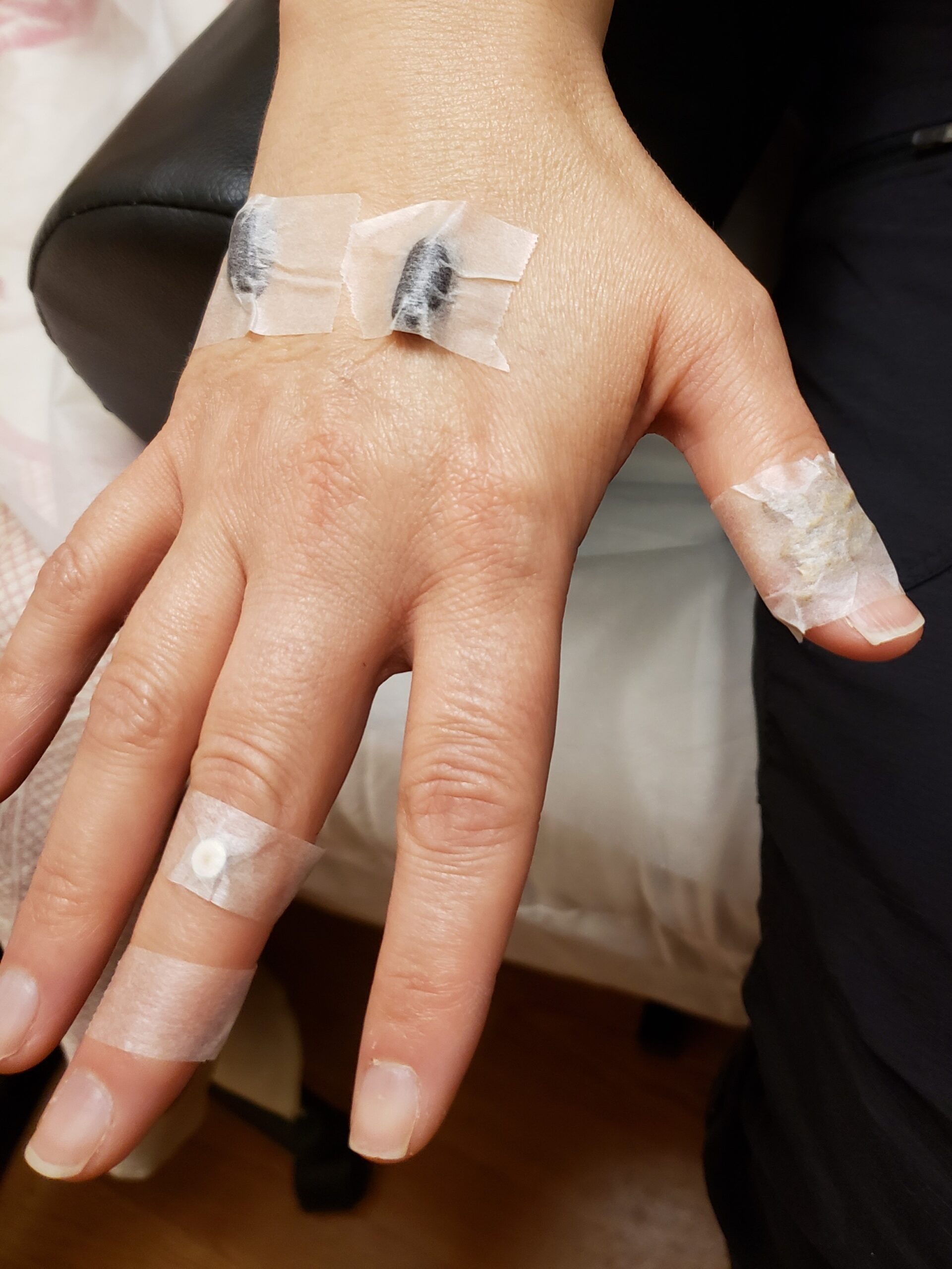 Strenghten your Kidneys with Kidney beans Navrung